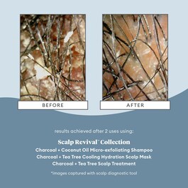 Scalp Revival Charcoal - Shampoo esfoliante