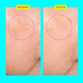 Bouncy Brightfacial™ - Maschera Viso Purificante