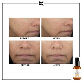Powerful Strength Line Reducing Concentrate - Siero viso antirughe