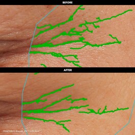 Lift & Firm - Crema occhi levigante e rassodante