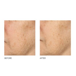 Alpha Beta® - Peeling quotidiano a formula universale
