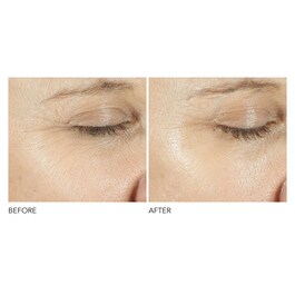 Advanced Retinol + Ferulic - Siero contorno occhi a tripla correzione