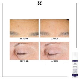 Retinol Skin-Renewing Daily Micro-Dose Serum - Siero antirughe
