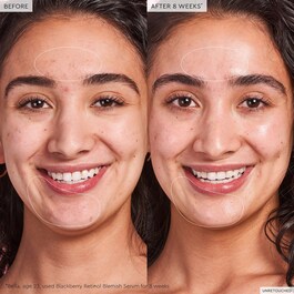 Blackberry Retinol - Siero Reset