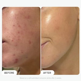 The Plump & Glow Kit - Set illuminante e rimpolpante
