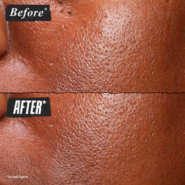 Ultra Pure High-Potency Serum 5.0% Niacinamide - Siero Viso