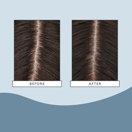 Scalp Revival - Maschera per cuoio capelluto idratante e rinfrescante