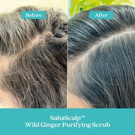 Kit rigenerazione cuoio capelluto SahaScalp™ - Cofanetto trattamenti capillari