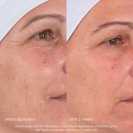 Dynamic Skin Retinol Serum - Siero Anti-Age al Retinolo