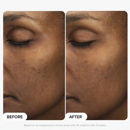 Skin Perfecting - Lozione Esfoliante 6% Acido Mandelico + 2% Acido Lattico