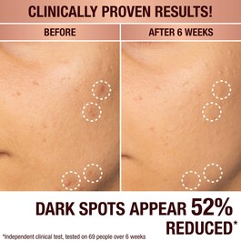 Dark Spot Correcting Radiance Recovery Serum - Siero Anti-Macchie
