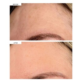 Dark Spot Correcting Serum - Siero Correttore Delle Macchie Scure