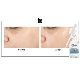 UP-THE-MOISTURE STARTER SET - Cofanetto Viso