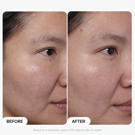 Clinical - Siero 20% Niacinamide