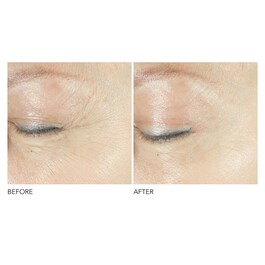 Advanced Retinol + Ferulic - Siero contorno occhi a tripla correzione