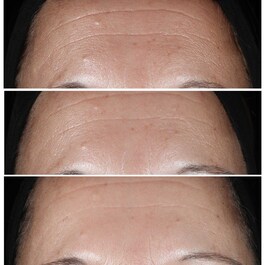 Clinique Smart Clinical Repair™ - Siero Correttore Anti-rughe