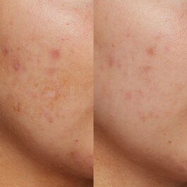 B3 Nice 10% Niacinamide - Siero luminosità