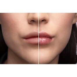Lip Injection - Balsamo per labbra