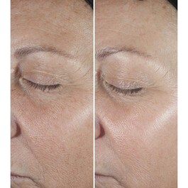 Clinique Smart Clinical Repair™ - Siero Correttore Anti-rughe