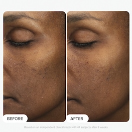 Multi-Level Exfoliation Trial Kit - Discovery Set con esfolianti AHA + BHA
