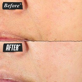 Super Multi-Corrective Cream - Tratt.viso 24 ore antirughe e illuminante