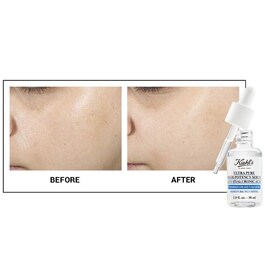 Ultra Pure High-Potency Serum 1.5% Hyaluronic Acid - Siero Viso