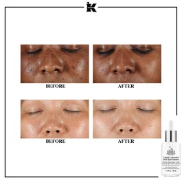 Clearly Corrective Dark Spot Solution - Siero viso antimacchie