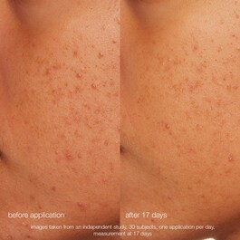 Daily Microfoliant - Polvere esfoliante a base di Crusca di Riso