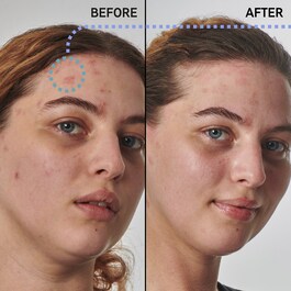 Soluzione per pelle secca e ruvida con urea al 10% - Siero per il viso