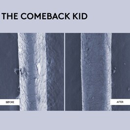 The Comeback Kid - Trattamento riparatore istantaneo