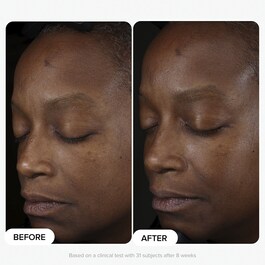 Boost - Booster 10% Niacinamide