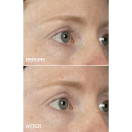 DermInfusions - Maschera Contorno Occhi Liftante + Rigenerante