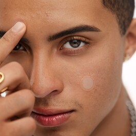 Cerotti per il trattamento dell'acne - Microneedling