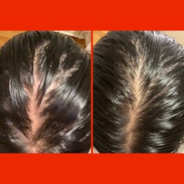 HoliRoots - Olio rinforzante per capelli