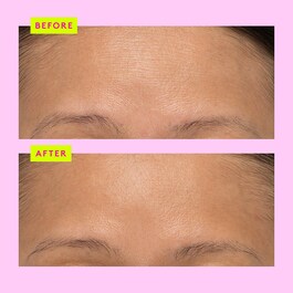 T.L.C. Framboos™ Glycolic Night Serum - Siero Notte Con Acido Salicilico