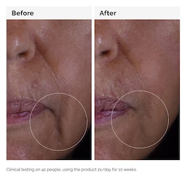 Solution GF 15% - Siero anti-age