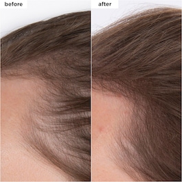 Destined For Density™ - Siero densificante per capelli