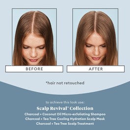 Scalp Revival Charcoal - Trattamento per il cuoio capelluto