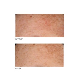 Alpha Beta® - Peeling quotidiano a formula universale