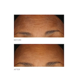 Alpha Beta® - Peeling quotidiano a formula intensiva