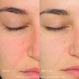 Daily Milkfoliant - Trattamento Viso Esfoliante