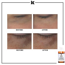 Powerful-Strength Line-Reducing & Dark Circle-Diminishing Vitamin C Eye Serum