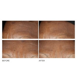 Advanced Retinol + Ferulic - Crema antirughe intensiva