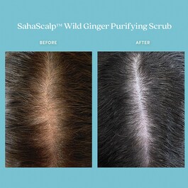 SahaScalp™ - Scrub purificante allo zenzero selvatico