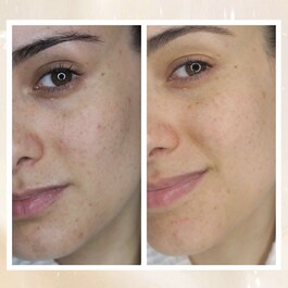 Overnight Glow -  Crema Notte Antimacchie