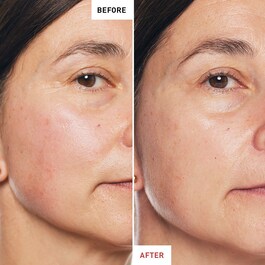Skin Therapy - Olio da notte multi-perfezionatore